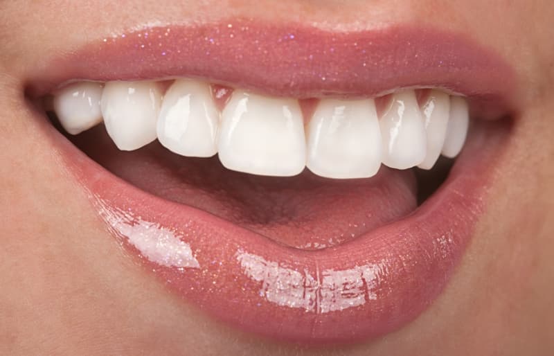 самые красивые зубы в мире фото